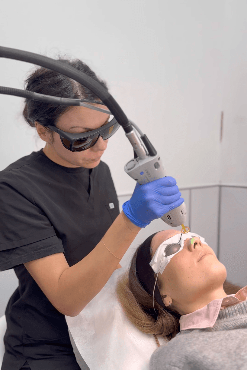 VISIA Skin Analysis + LaseMD Laser results at Khrom Dermatology & Aesthetics